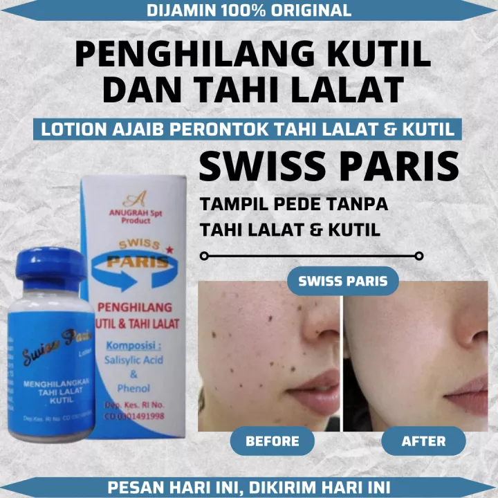 Jual Penghilang Tahi Lalat Penghilang Kutil Skin Tag Remover ORIGINAL