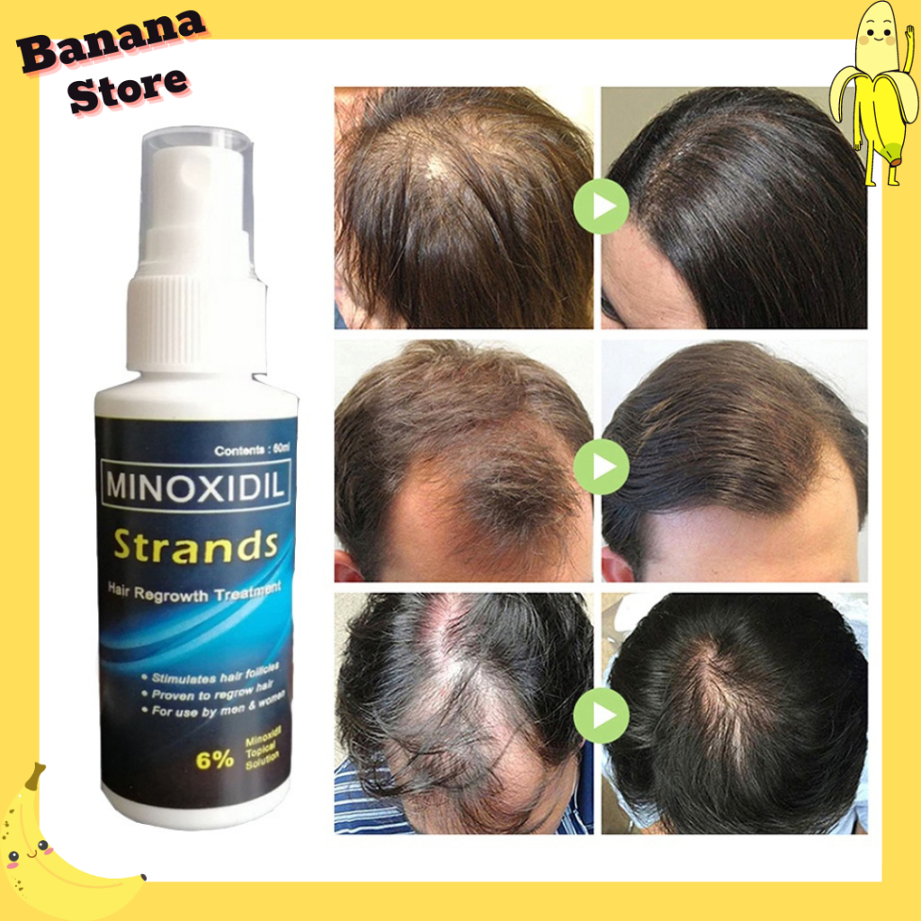 Jual Minoxidil Strands 6 Minoxidil Kirkland Minoxidil Original Topical