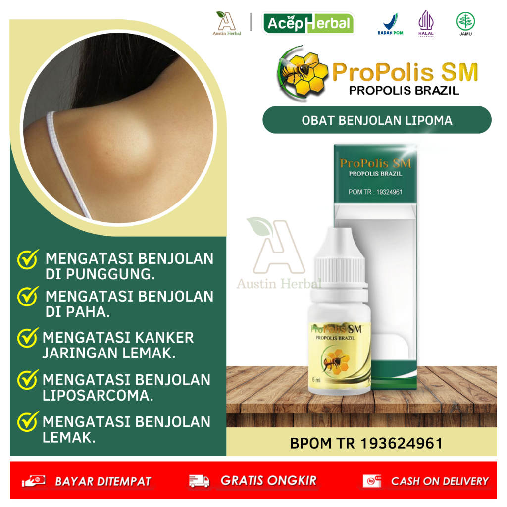 Jual Obat Lipoma Benjolan Di Punggung Benjolan Di Paha Benjolan Di