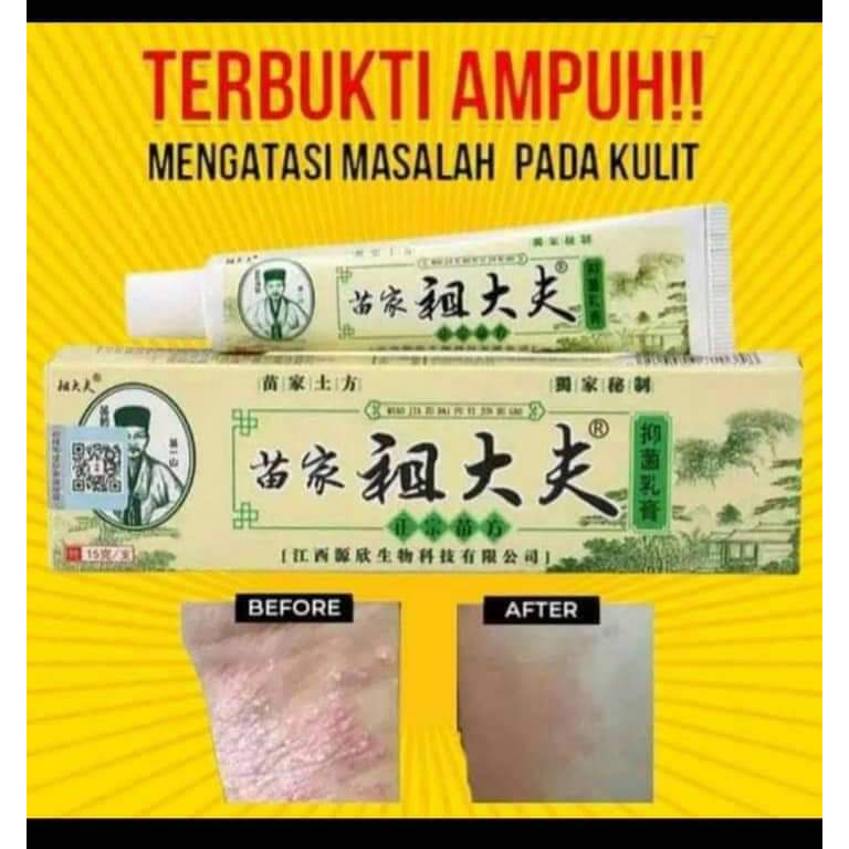 Jual Salep Zudaifu Original China Gr Obat Gatal Alergi Dan Penyakit