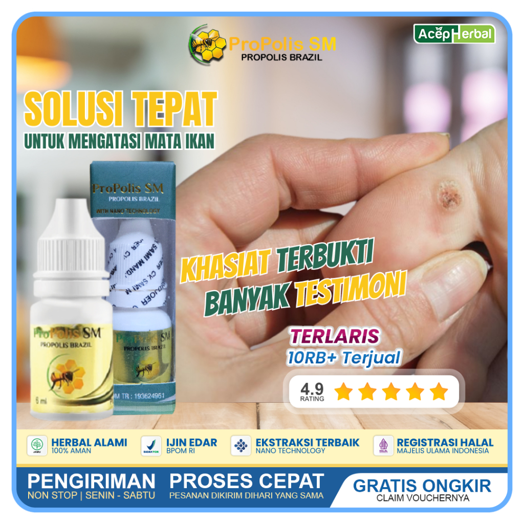 Jual Obat Mata Ikan Telapak Kaki Dan Tanagan Herbal Propolis Sm