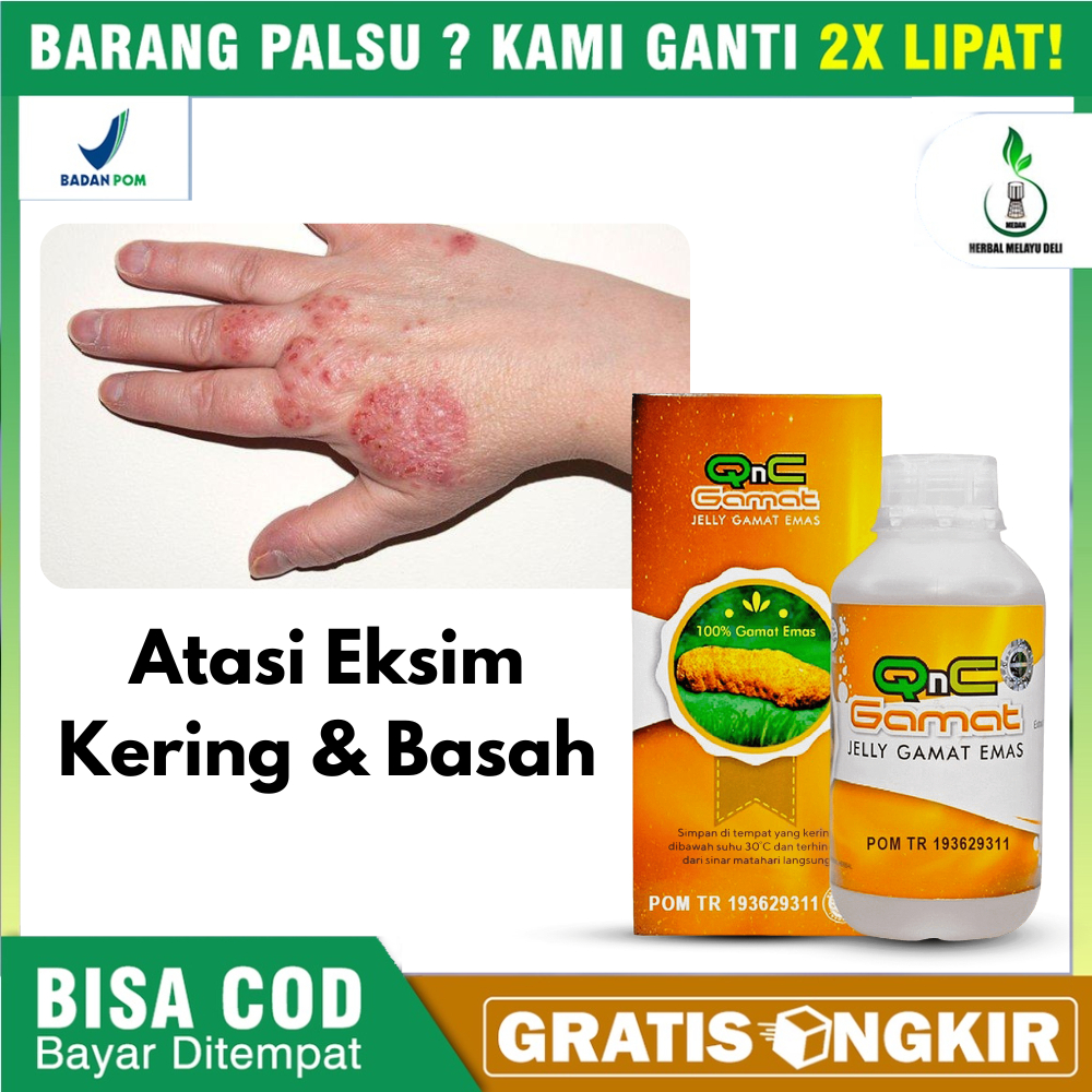 Jual Obat Oles Eksim Basah Dan Kering Obat Jamur Obat Gatal Gatal