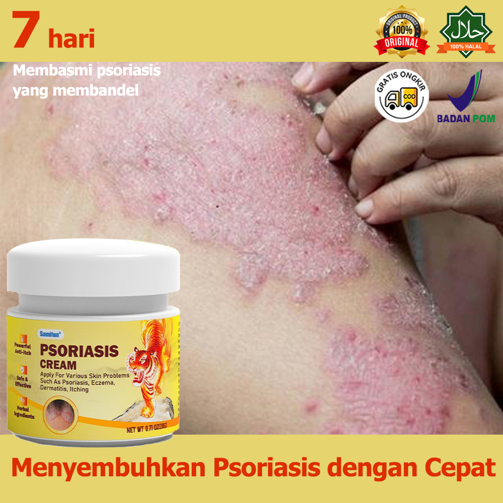 Jual 100 ORI Obat Gatal Obat Eksim Obat Kurap Salep Psoriasis Salep