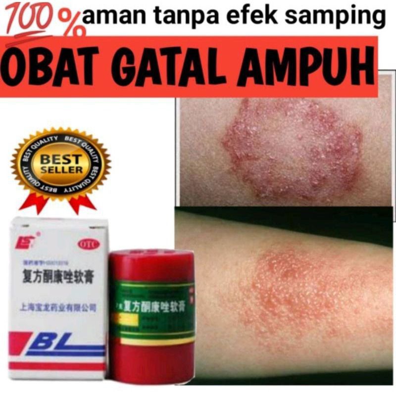 Jual Salep Bl Cream Untuk Salep Kulit Alergi Dan Obat Gatal Asli