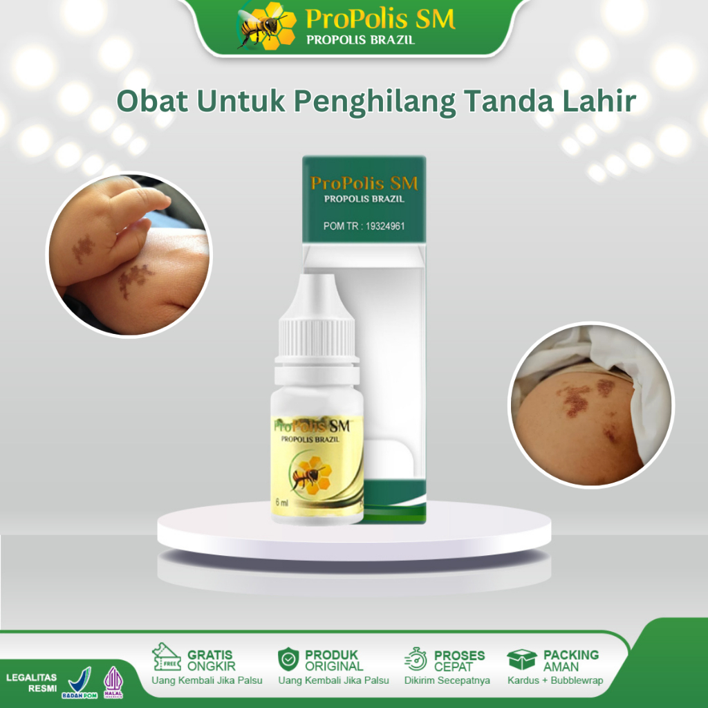 Jual Obat Penghilang Tanda Lahir Hitam Noda Hitam Di Muka Tompel Hitam