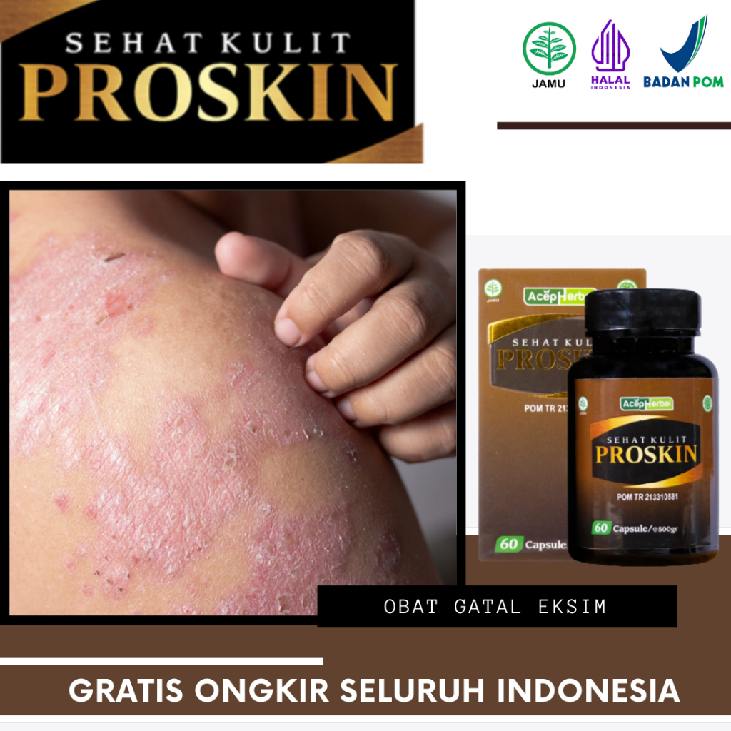 Jual Proskin Obat Gatal Eksim Eksim Kering Eksim Basah Eksim Di