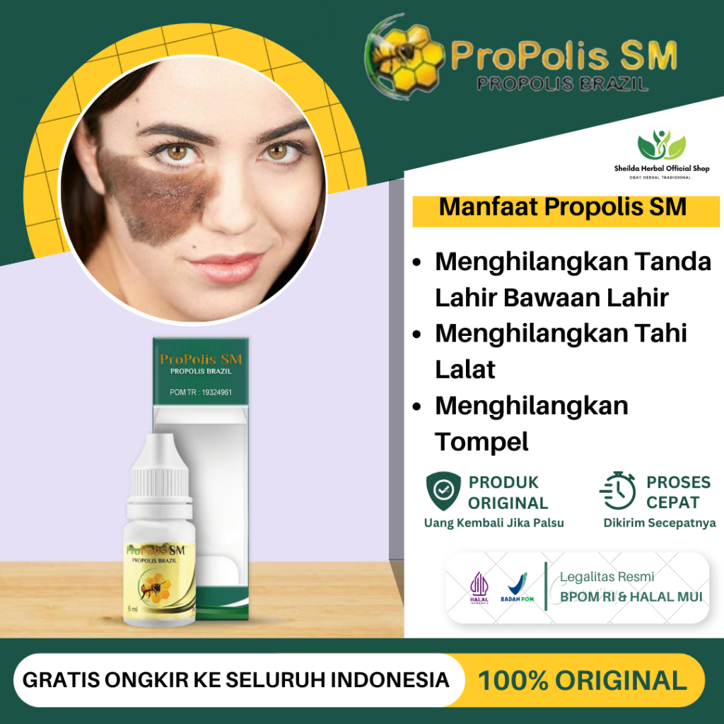 Jual Obat Penghilang Tanda Lahir Obat Memudarkan Tanda Lahir Hitam