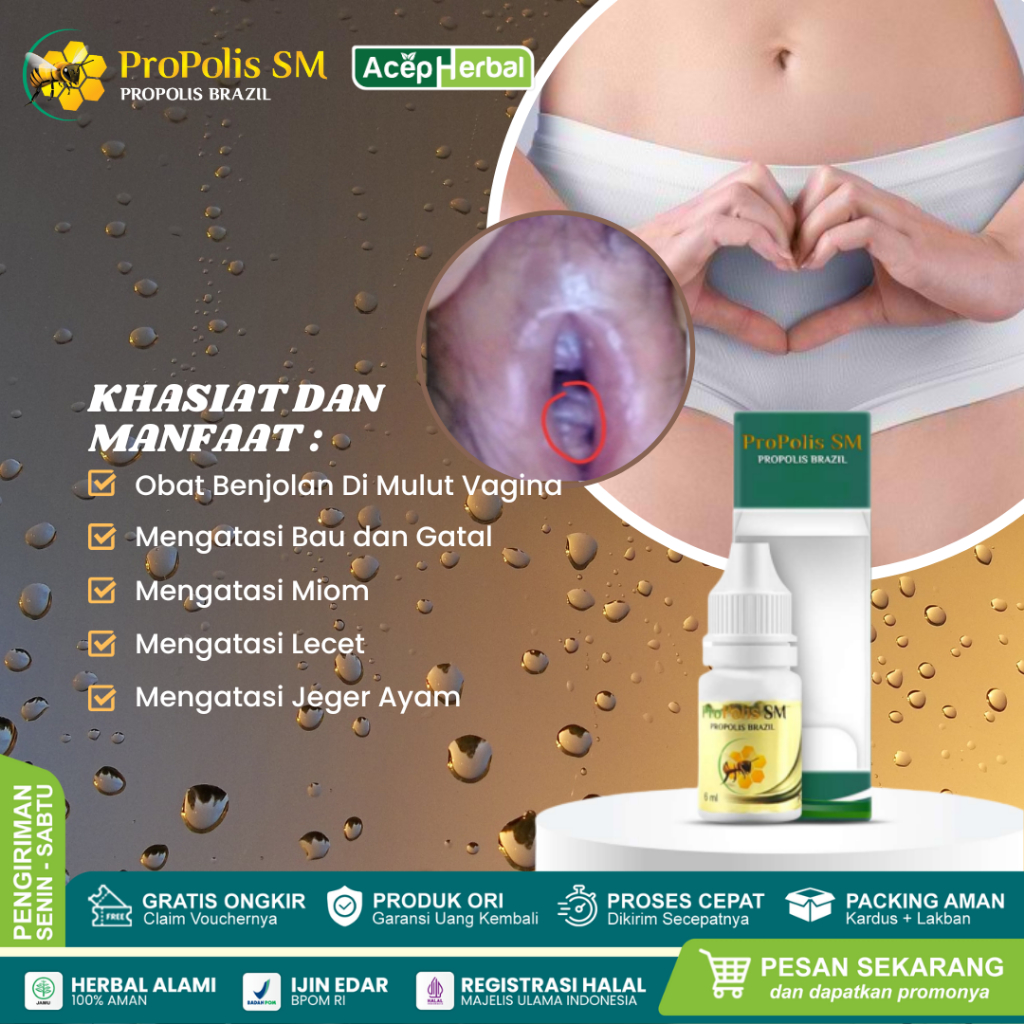 Jual Obat Tetes Penghilang Benjolan Di Miss V Obat Benjolan Bernanah