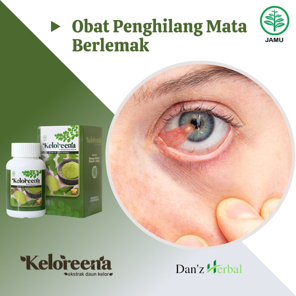 Jual Obat Mata Berlemak Pterygium Penghilang Lemak Di Mata Pembersih