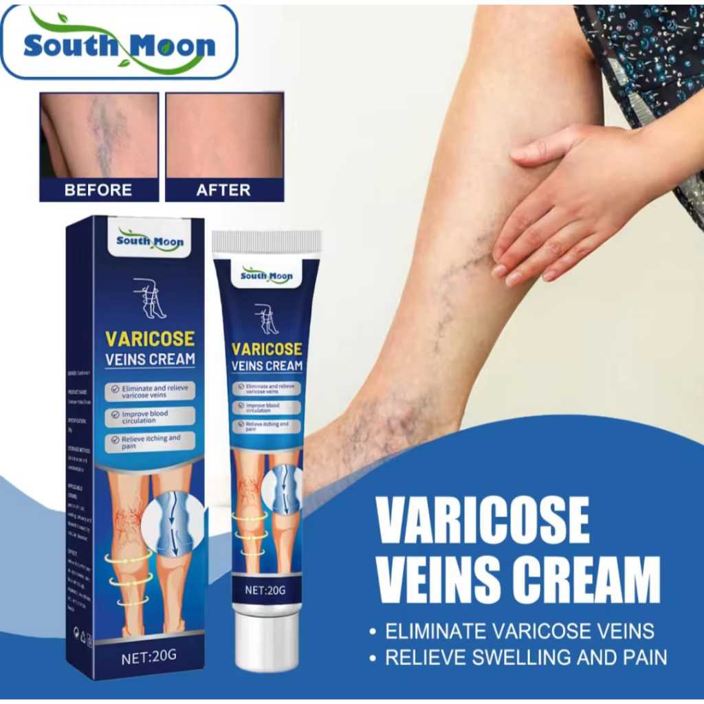 Jual Varicose Veins Obat Varises Di Kaki Dan Betis Paling Ampuh Salep