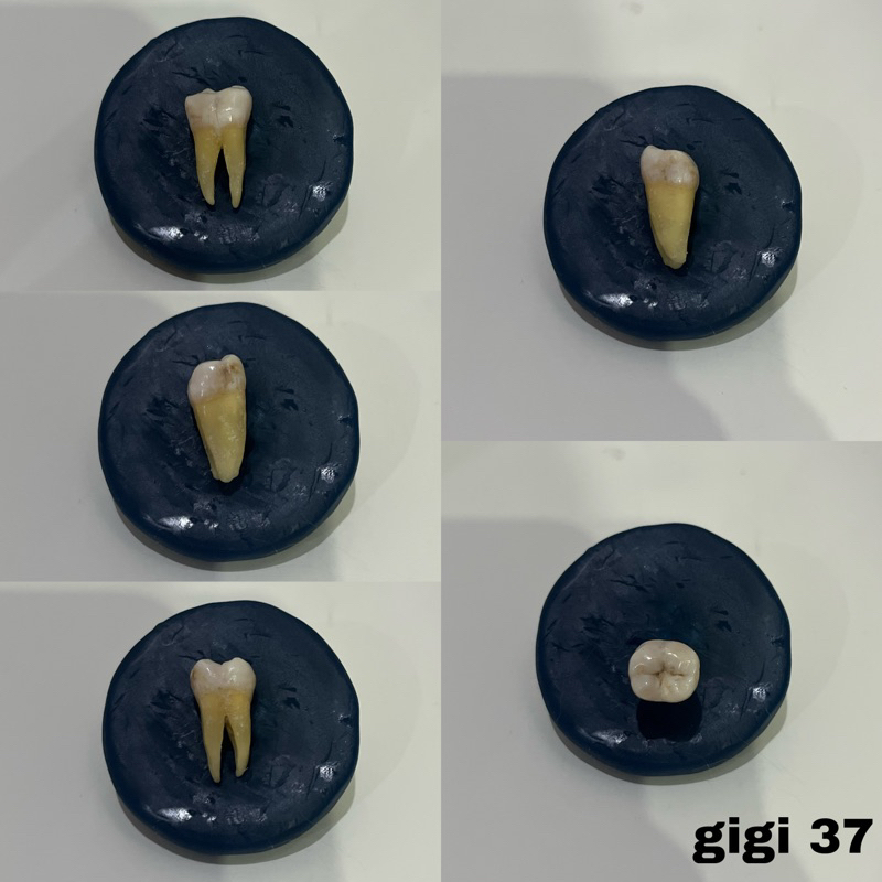 Jual Molar Bawah Gigi Graham Asli Praktikum