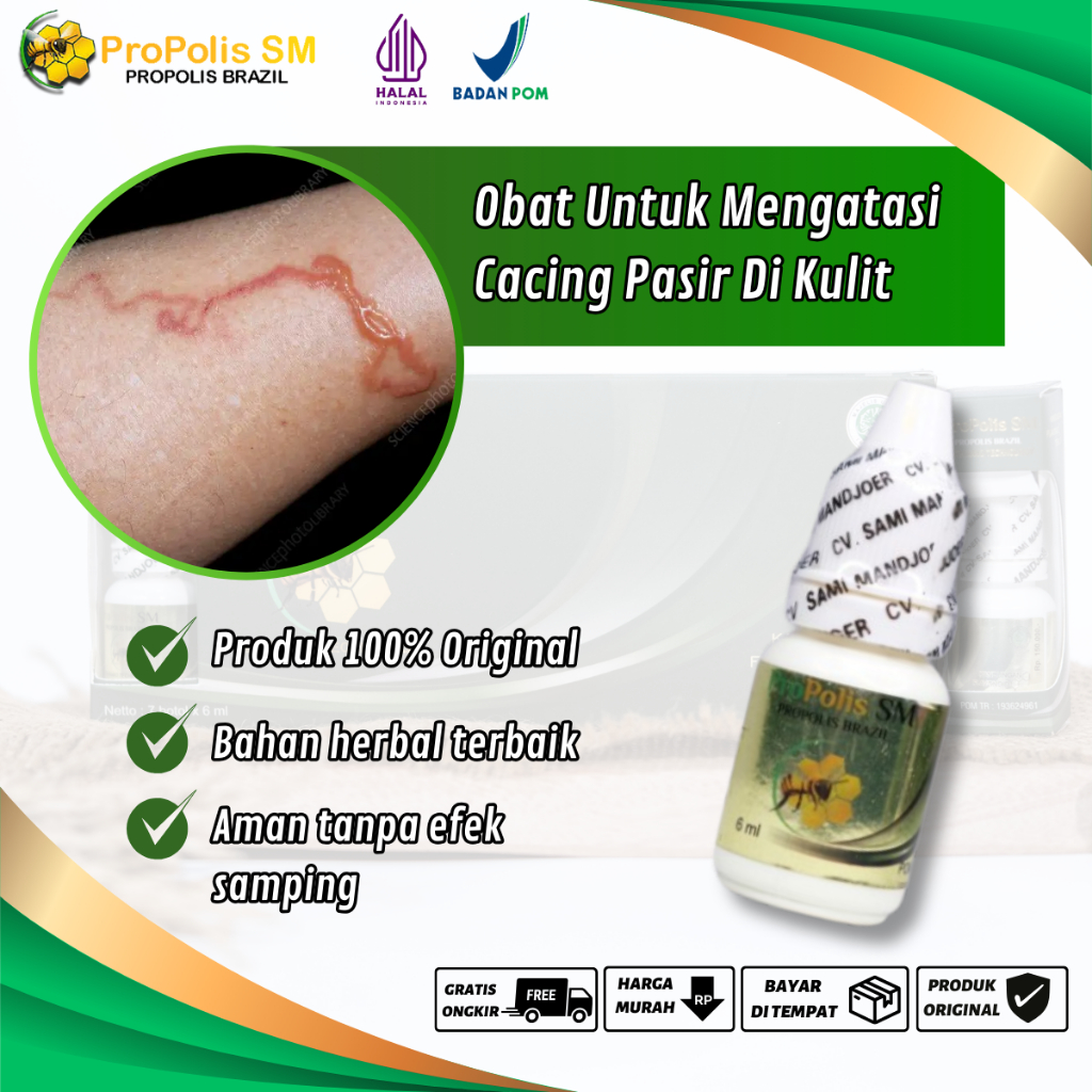 Jual Obat Cacing Pasir Di Kulit Infeksi Cacing Pasir Di Bawah Kulit