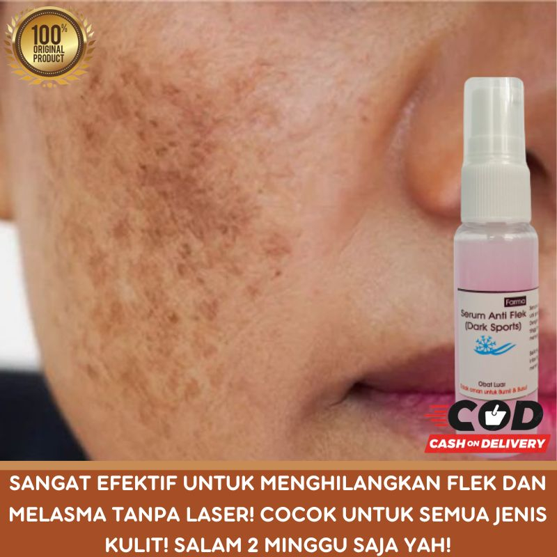 Jual Serum Penghilang Untuk Menghilangkan Flek Hitam Dark Spot Melasma