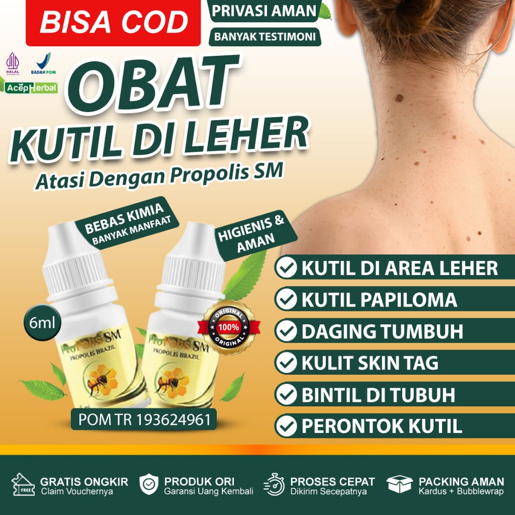 Jual Obat Papiloma Di Leher Penghilang Kutil Papiloma Di Wajah Kutil Di