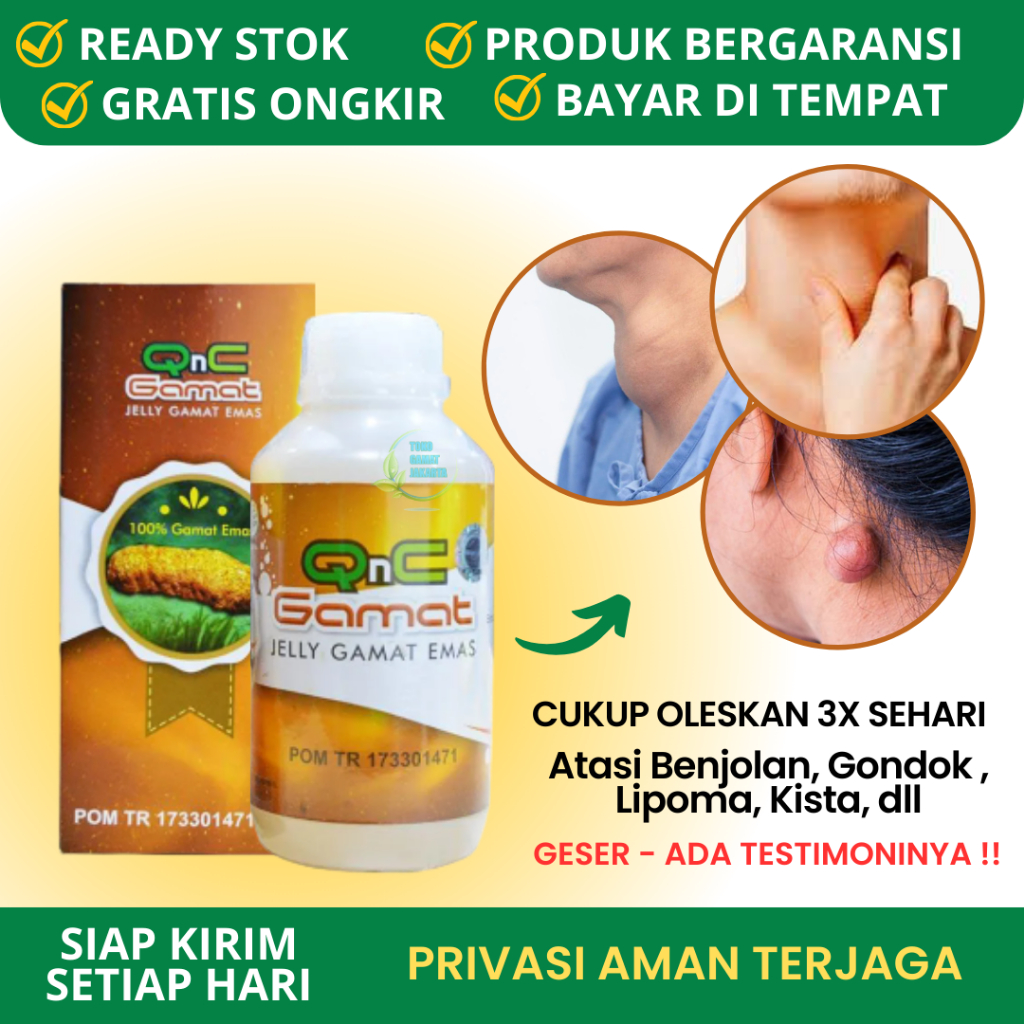 Jual Obat Penghancur Benjolan Di Leher Kanan Gondok Tumor Jinak