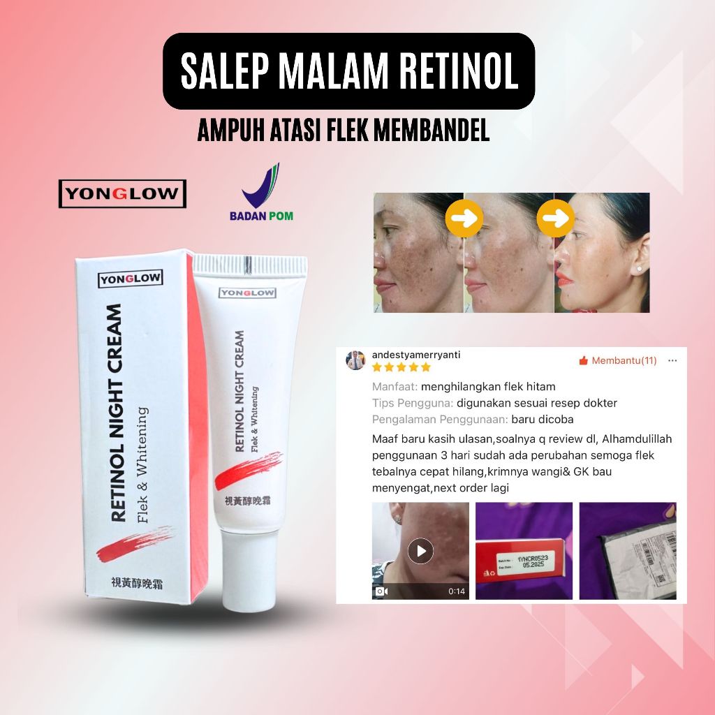 Jual Salep Cina Flek BPOM Yonglow Skincare Salep Malam Flek Noda Hitam