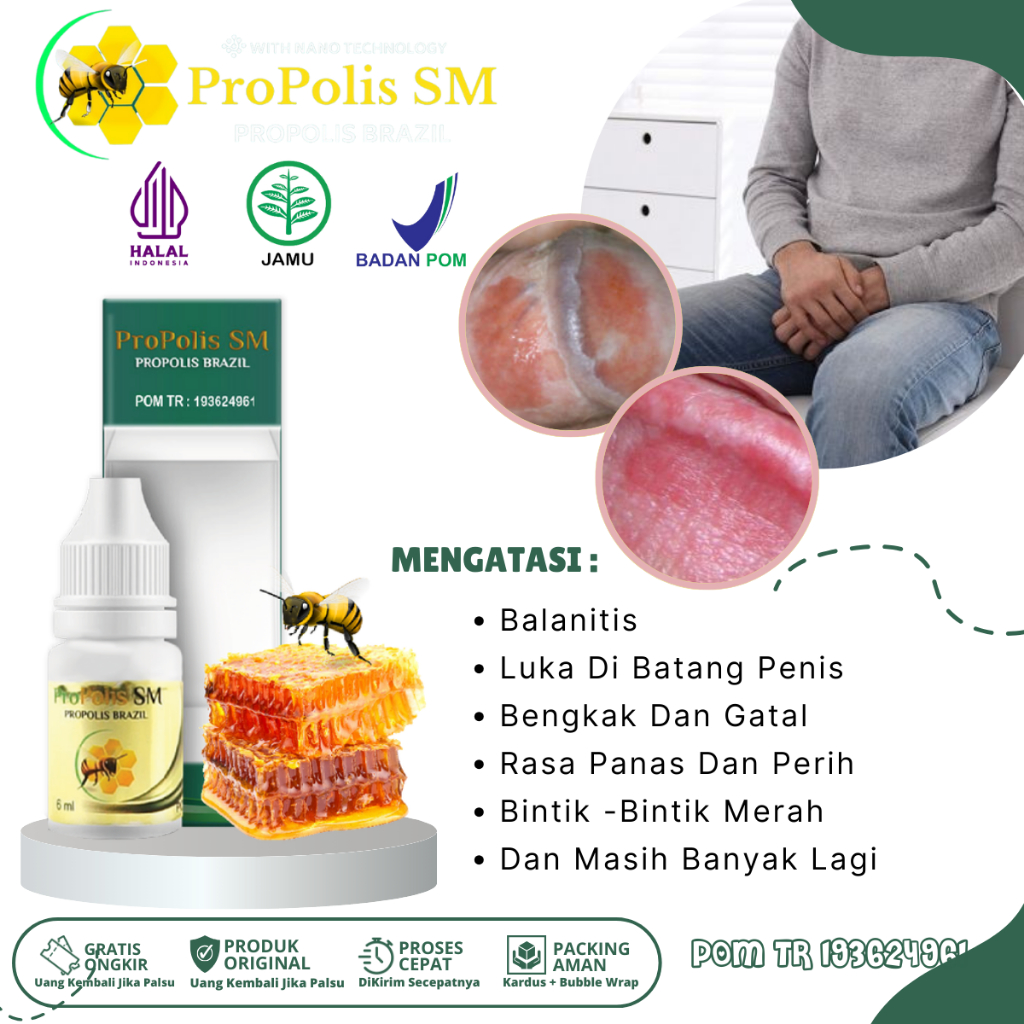 Jual Obat Balanitis Luka Lecet Pada Batang Penis Bengkak Dan Gatal