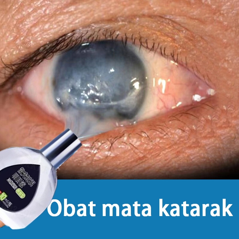 Jual Obat Tetes Mata Eye Drops Obat Tetes Mata Jepang Merah Obat Tetes