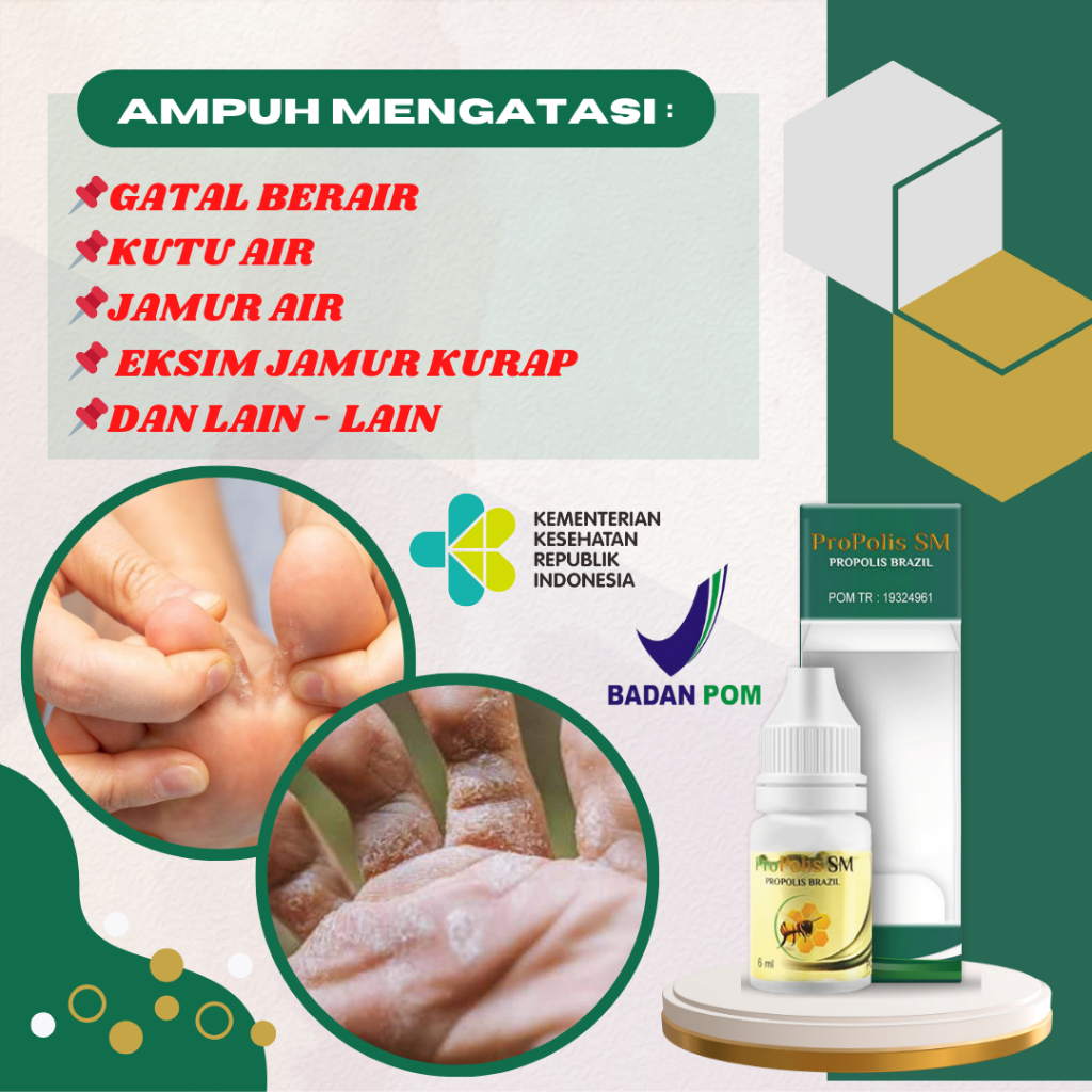 Jual Obat Kutu Air Untuk Kaki Kutu Air Di Tangan Obat Gatal Dan Kutu