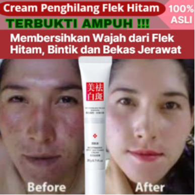 Jual Cream Salep Penghilang Flek Hitam Bintik Hitam Bekas Jerawat Krim