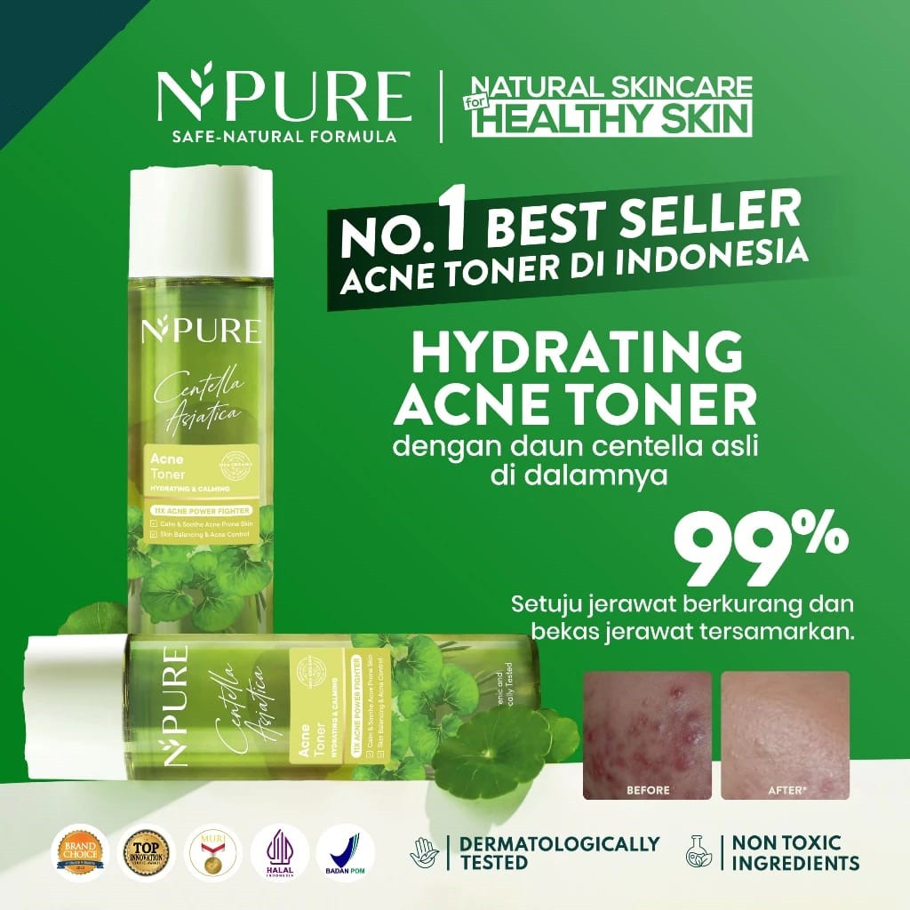 Jual LIVI Npure Centella Asiatica Acne Toner 150 Ml Shopee Indonesia