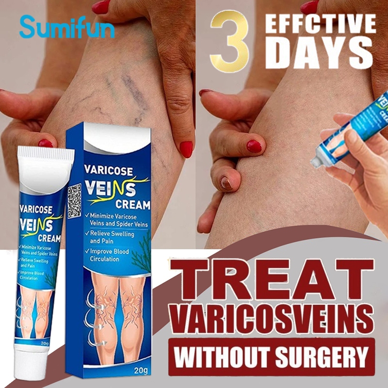 Jual SUMIFUN Varicose Vein Buster 20g Veins Obat Varises Salep