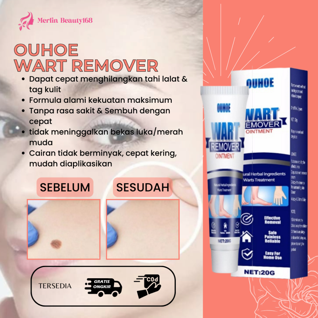 Jual Ouhoe Eelhoe Wart Remover Original