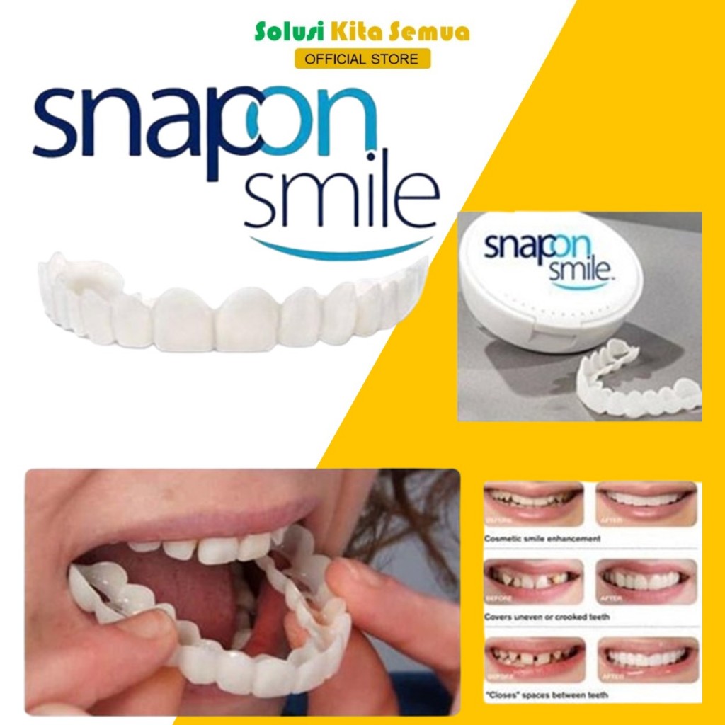 Jual Gigi Palsu Instan Atas Bawah Venner Snap On Smile Original