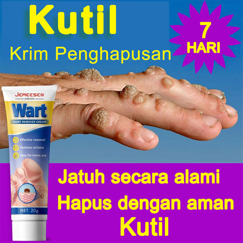 Jual Jemeesen Effective Warts Remover Original Cream Pure Kasoy Oil