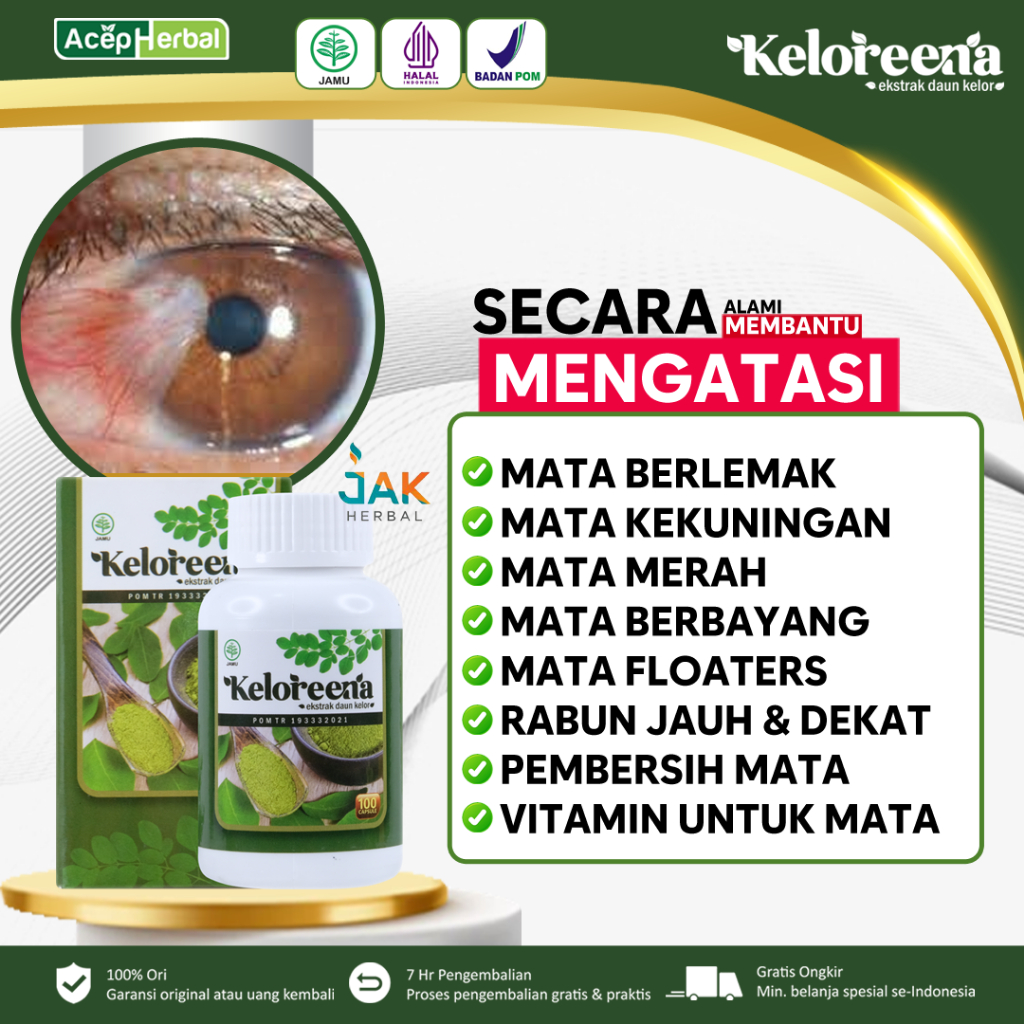 Jual Obat Mata Berlemak Mata Merah Mata Kuning Mata Rabun Jauh Dan