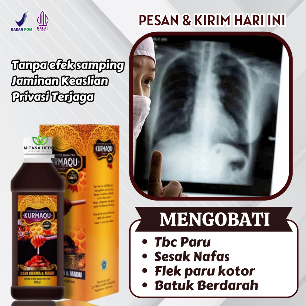 Jual Obat TBC Paru Obat Sesak Nafas Pembersih Paru Paru Obat Batuk