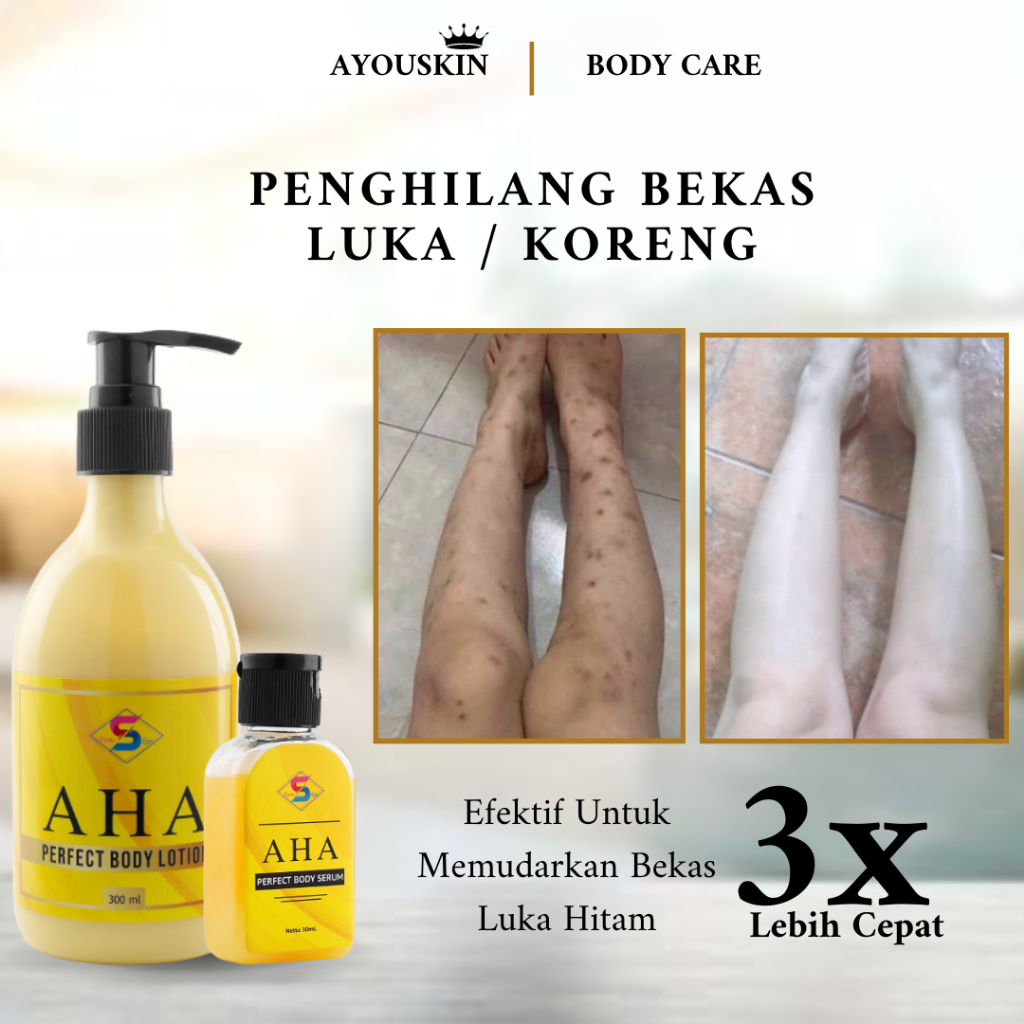 Jual Body Lotion Penghilang Bekas Luka Koreng Penghilang Koreng Hitam