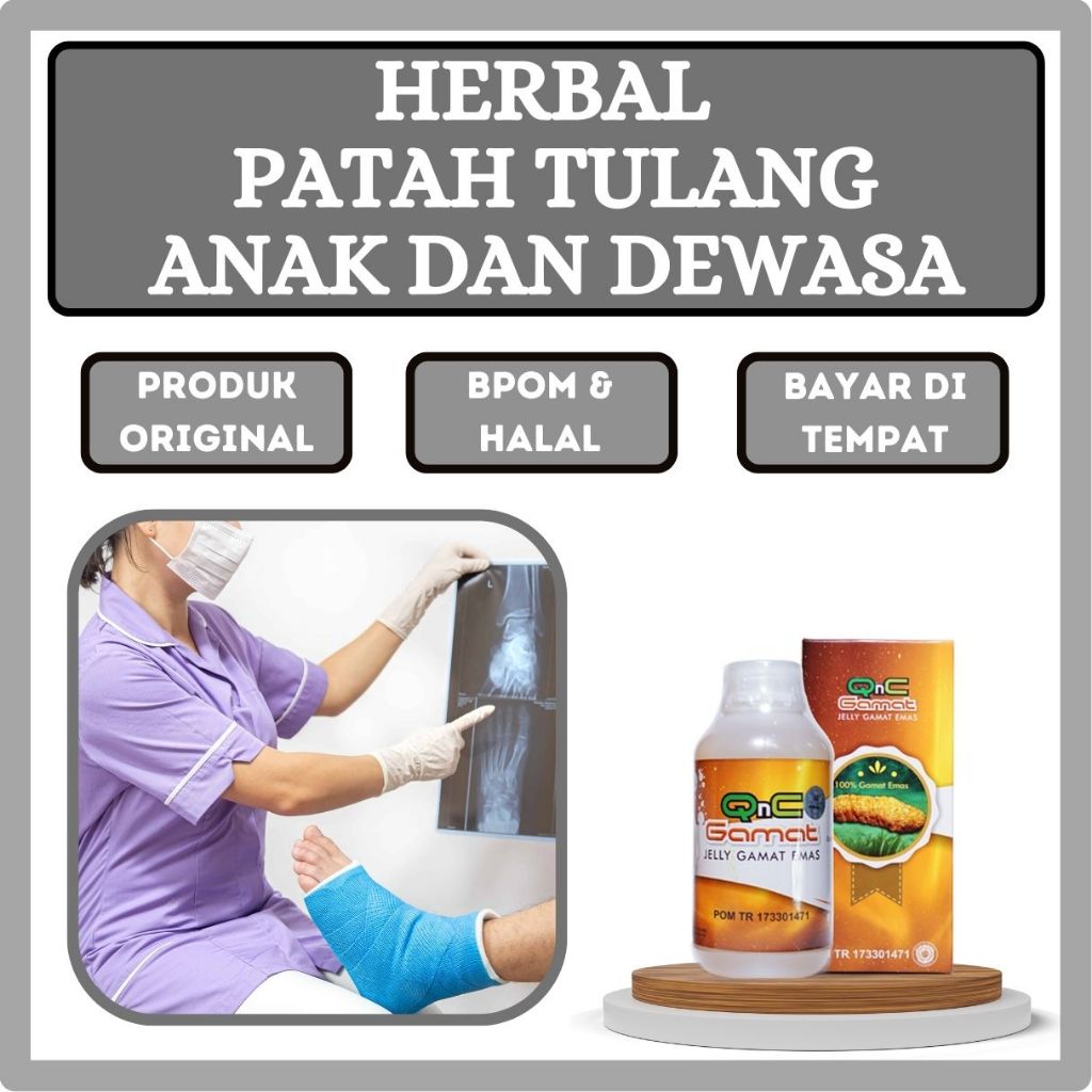 Jual Obat Patah Tulang Akibat Jatuh Atau Kecelakaan Tulang Retak