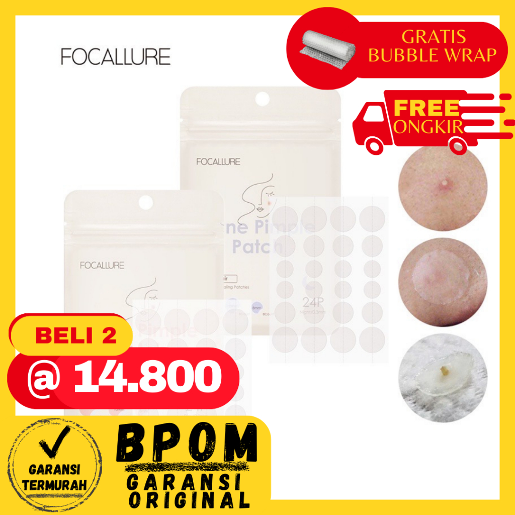 Jual Focallure Acne Patch Spot Patch Focallure Pimple Patch Acne