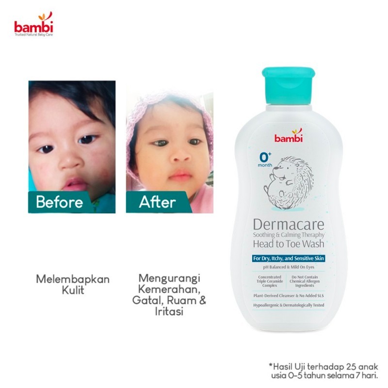 Jual Bambi Baby Dermacare Head To Toe Wash Sabun Bayi Kulit Sensitif