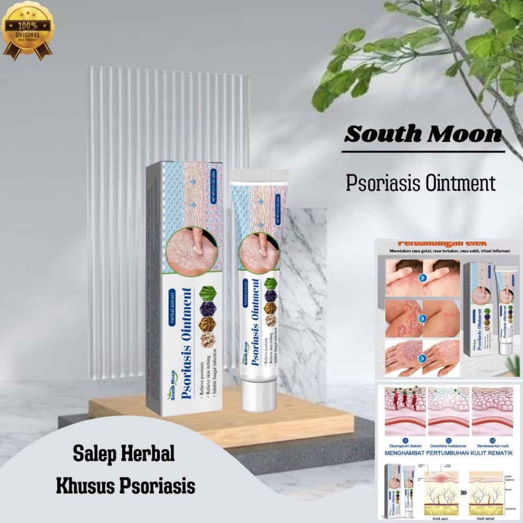 Jual South Moon Psoriasis Ointment Salep Herbal Efektif Mengatasi