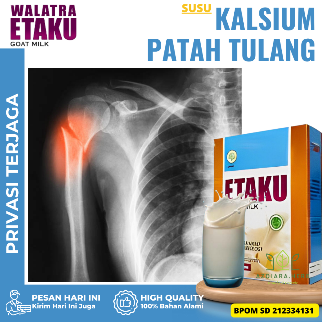 Jual Susu Kalsium Untuk Patah Tulang Obat Penyembuh Patah Tulang Obat