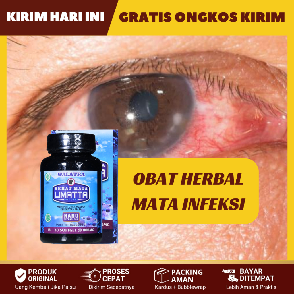 Jual Obat Mata Merah Dan Gatal Obat Mata Perih Dan Berair Obat Mata