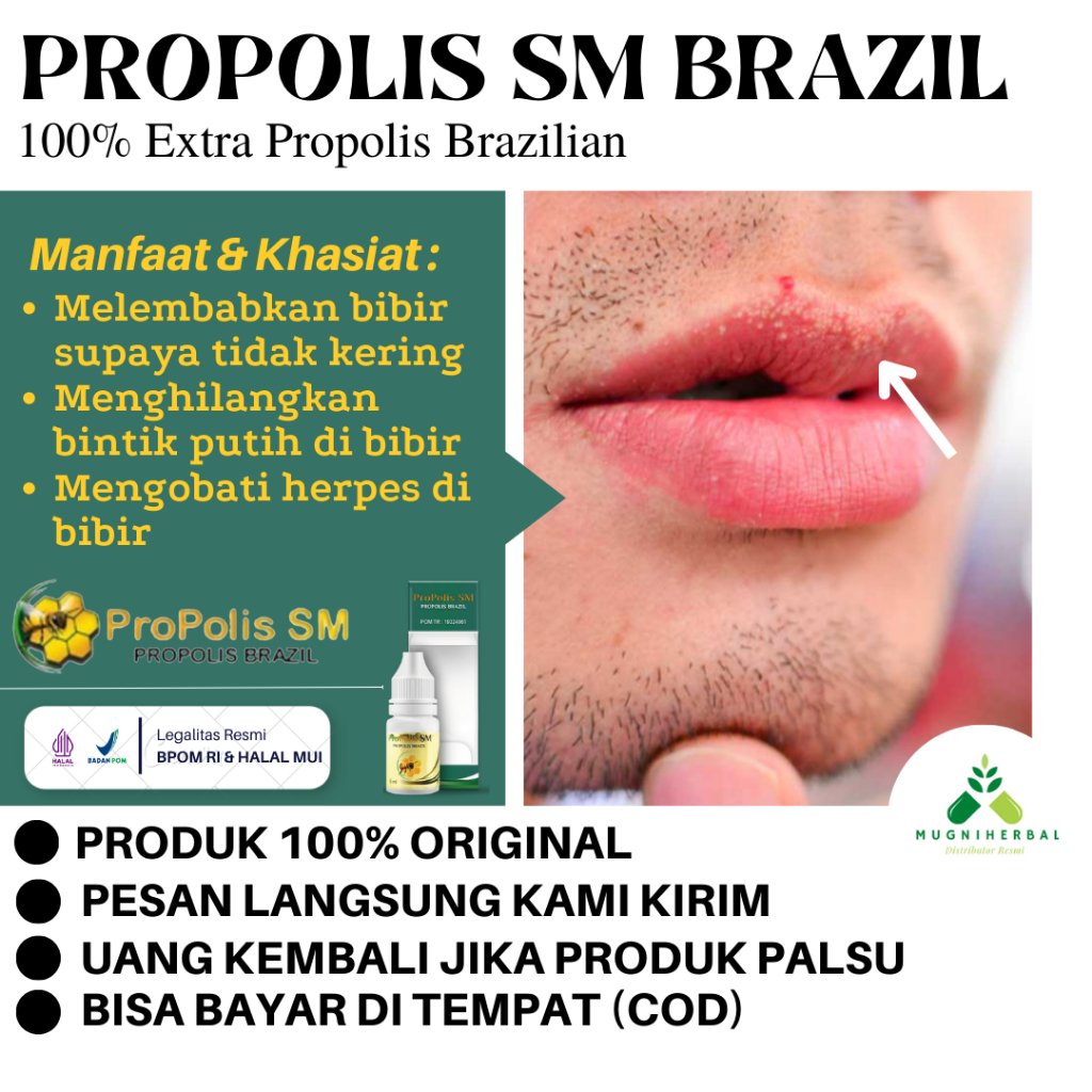 Jual Propolis Sm Obat Bintik Putih Di Bibir Bibir Pecah Pecah Dan