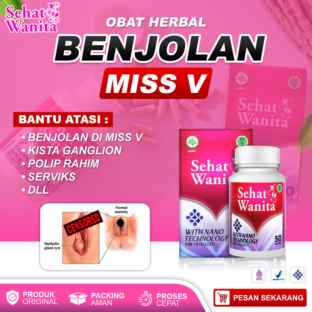 Jual Obat Pengempis Benjolan Di Vagina Kista Bartholin Benjolan Di