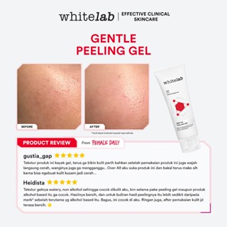 Jual Whitelab Gentle Peeling Gel Gel Pengangkat Sel Kulit Mati Untuk