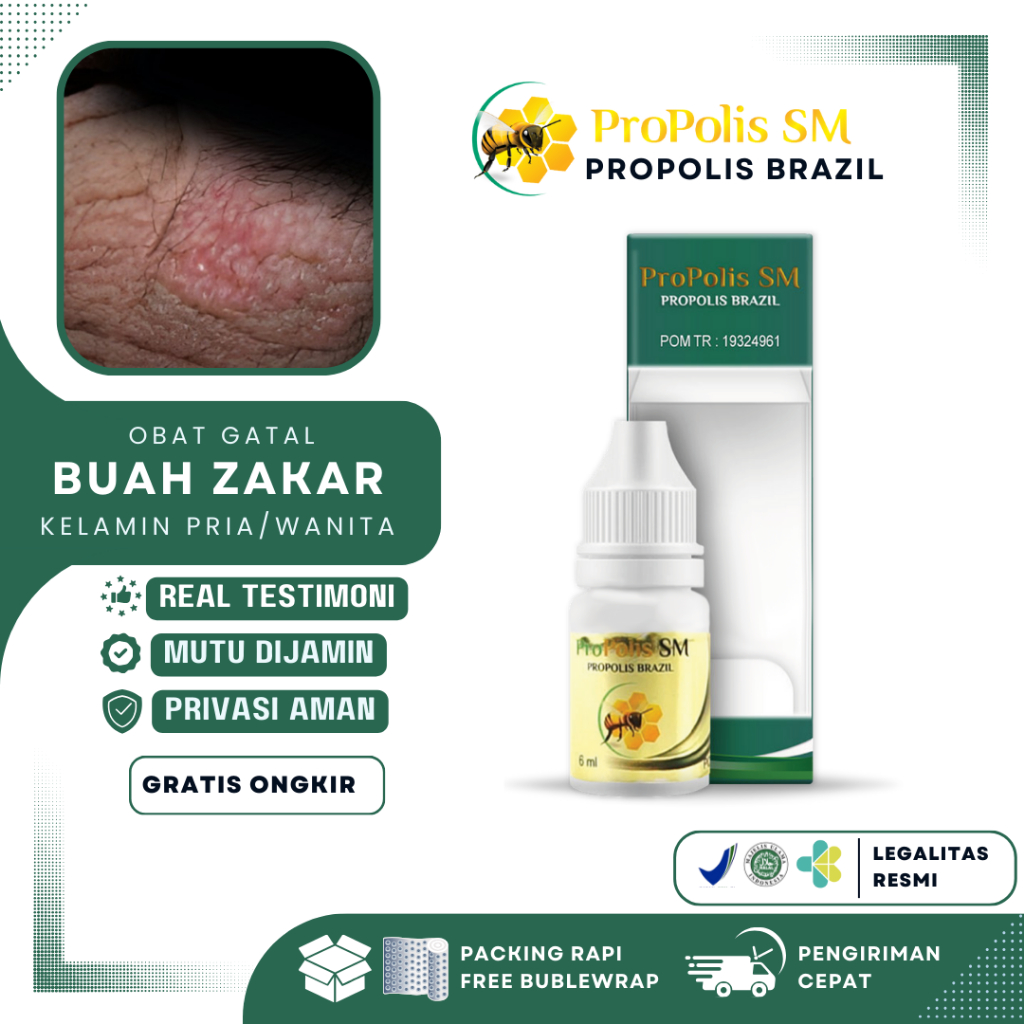 Jual Obat Gatal Kelamin Untuk Pria Wanita Buah Zakar Selangkangan Babak