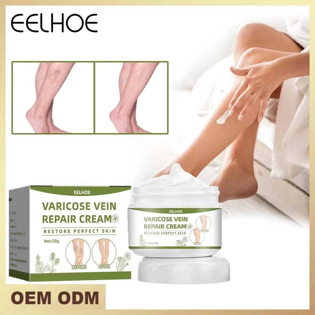 Jual EELHOE Varicose Veins Cream 50G Obat Varises Salep Krim Permanen