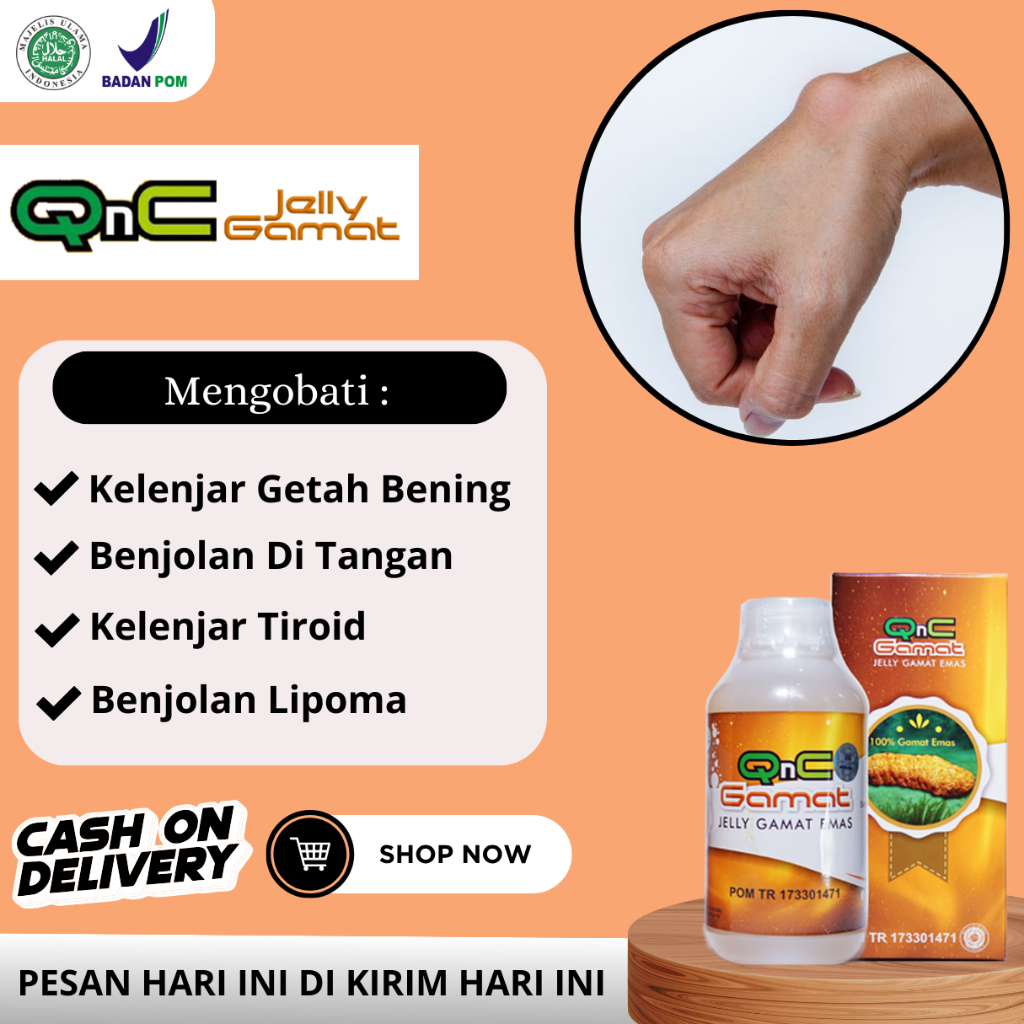 Jual Obat Herbal Benjolan Di Tangan Kelenjar Getah Bening Benjolan