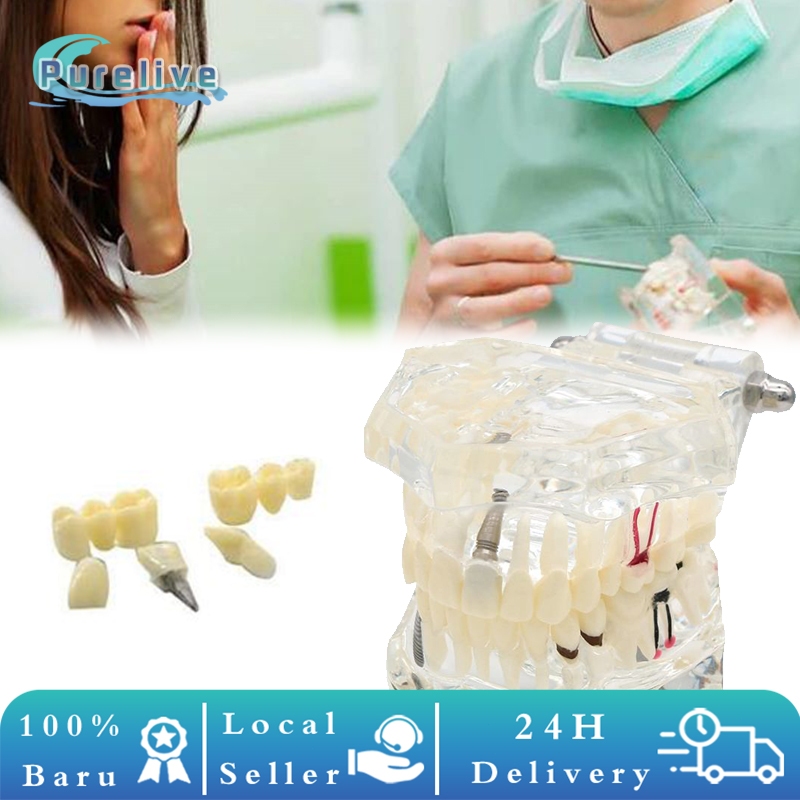 Jual Dental Study Model Gigi Transparant Model Phantom Gigi Bisa Di