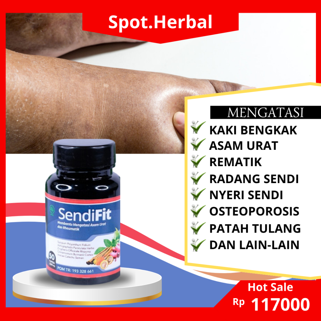 Jual Obat Kaki Bengkak Karena Asam Urat Rematik Radang Sendi