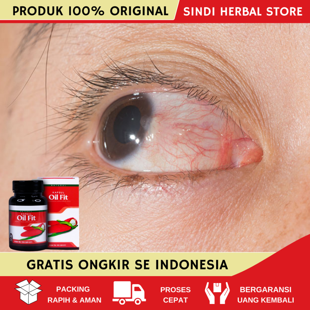 Jual Obat Mata Berlemak Kekuningan Mata Kering Sakit Mata Darah Merah