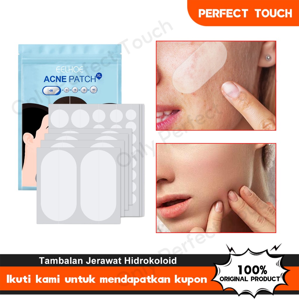 Jual Eelhoe Acne Patch Murah Patch Jerawat Acne Karakter Stiker Acne