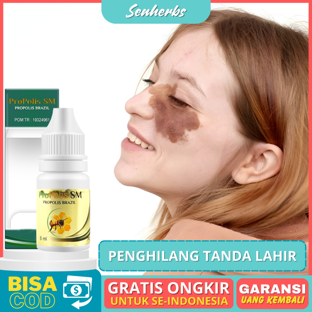 Jual Obat Penghilang Tanda Lahir Hemangioma Meudarkan Tanda Lahir Hitam