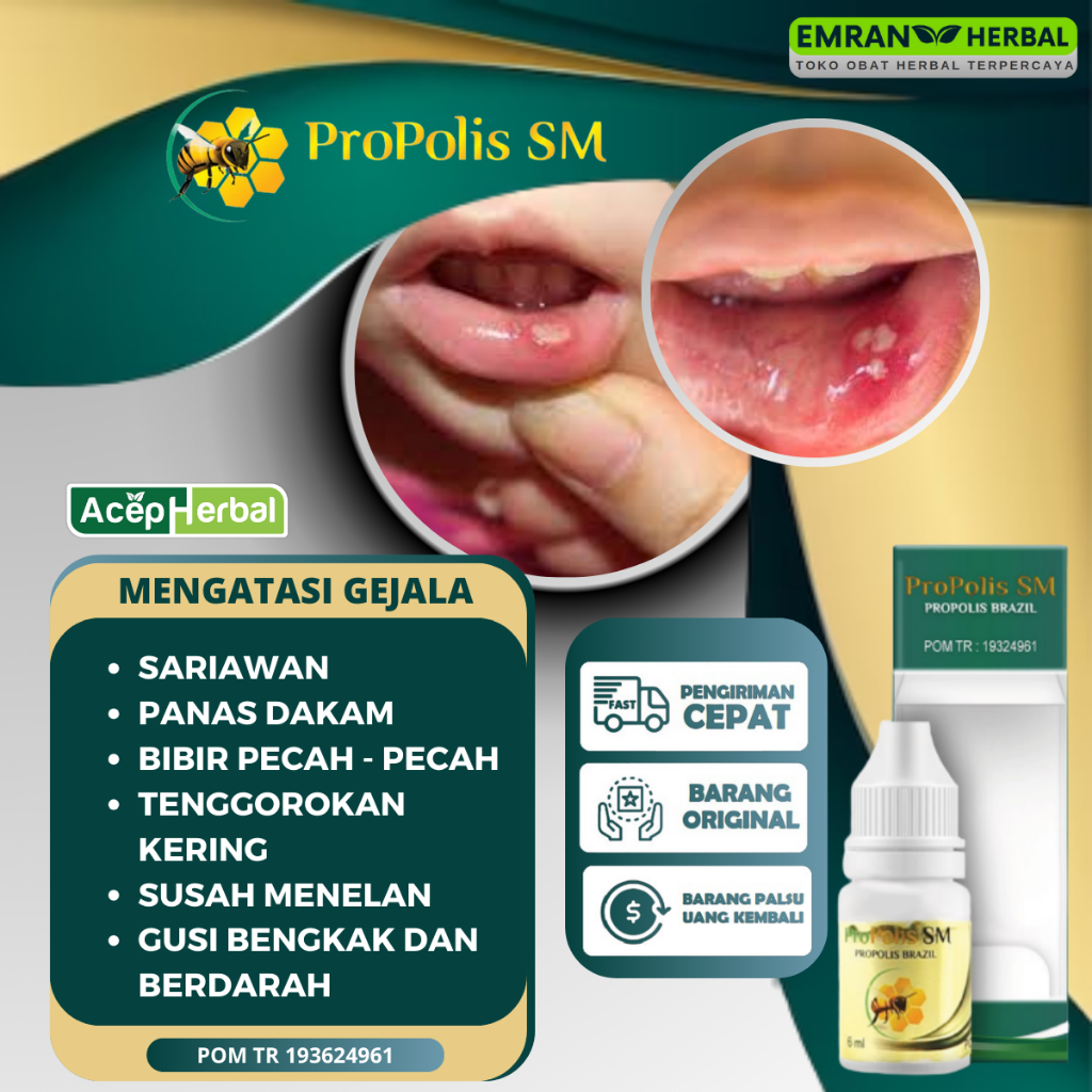 Jual Obat Sariawan Panas Dalam Bibir Pecah Pecah Tenggorokan Kering